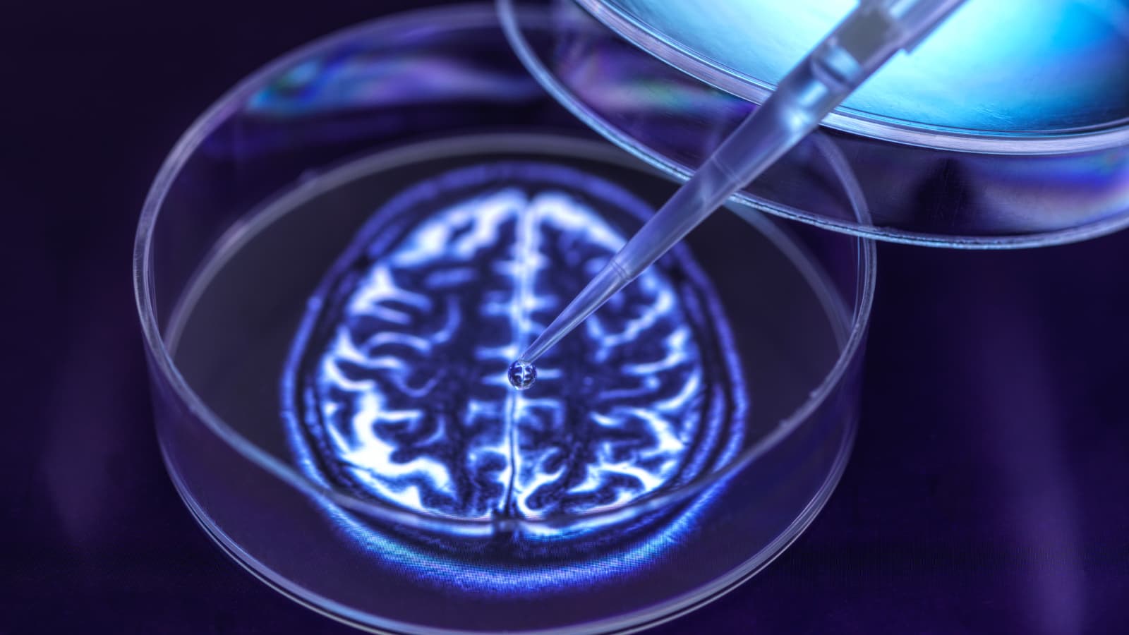 Hình ảnh khái niệm về các organoid não. Đường viền phát sáng của bộ não con người ở trung tâm của đĩa petri.