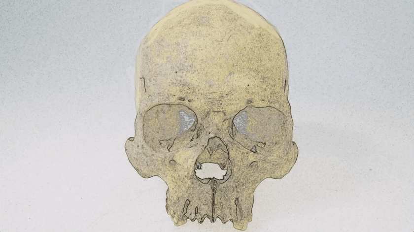 A human skull against a white background