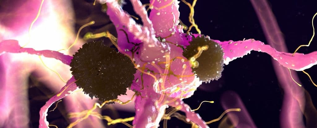 Tín hiệu ẩn trong não có thể phát hiện Alzheimer từ nhiều năm trước