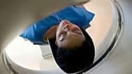 Chụp CT trước khi mang thai có thể tăng nguy cơ kết quả sinh kém
