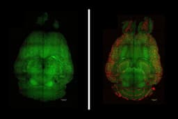 Các nhà khoa học đảo ngược Alzheimer ở chuột – liệu áp dụng cho người?