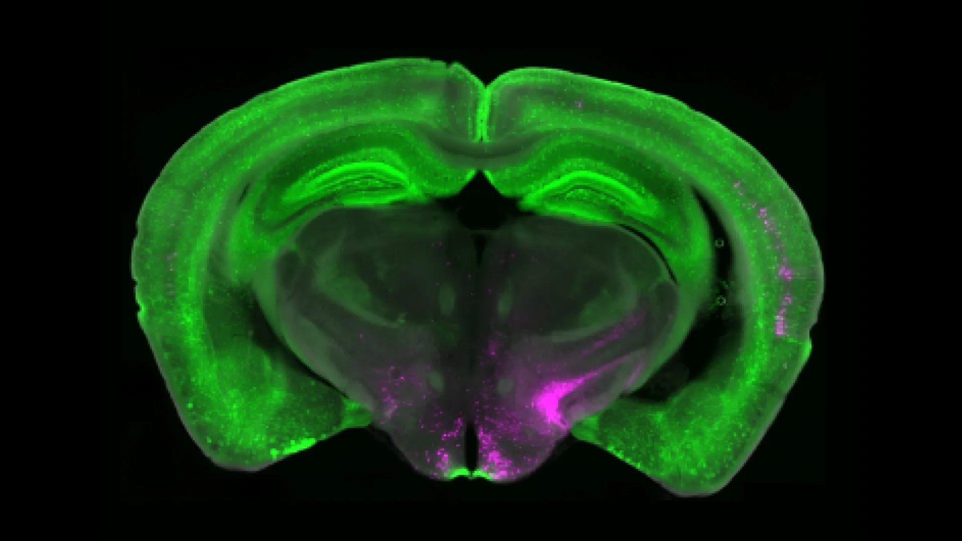 Scientists Uncover Brain’s Hidden Pain Switch